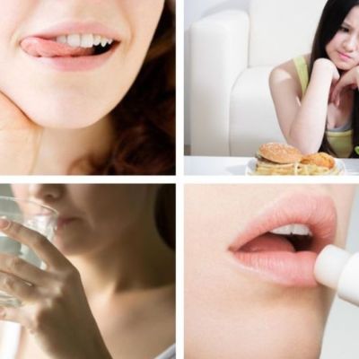 chăm sóc môi trước ngày cưới