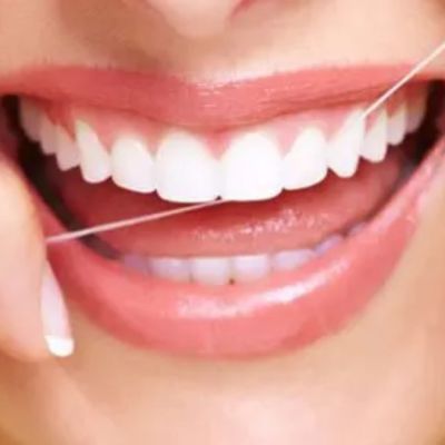 chăm sóc răng miệng ngày cưới