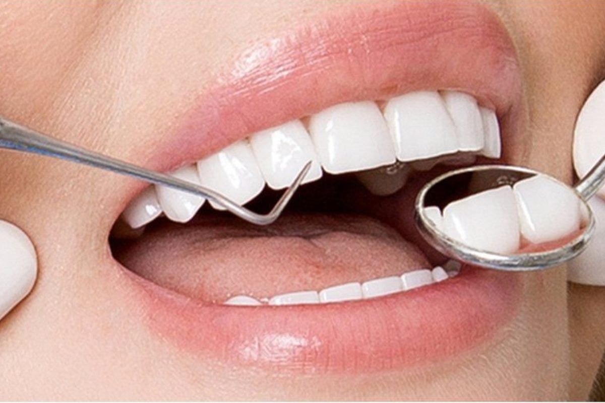 Chăm sóc răng tại phòng khám (Ảnh: sưu tầm)