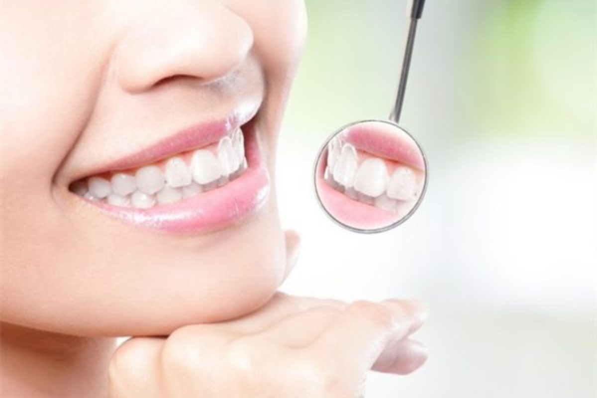 Các mẹo cấp cứu trong ngày cưới (Ảnh: sưu tầm)